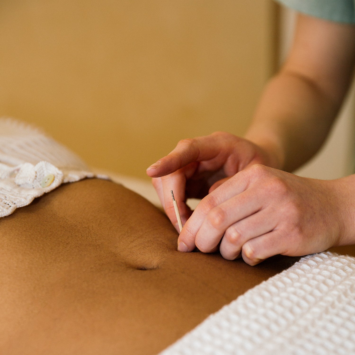 Balancing your cycle with acupuncture